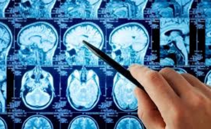 Beyin kanamasını 1 dakikada tespit eden teknoloji Cerrahpaşa'da