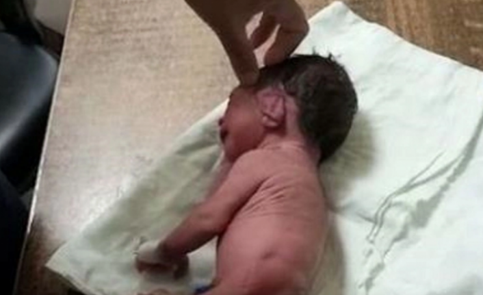 Doktorlar ayak yerine boynuzla doğan bebeği görünce şaşkına döndü